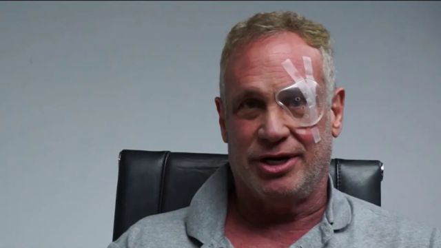 Palmetto Bay Man Seeks Justice After Being Shot in Eye with Water Pellet by Kids (1)