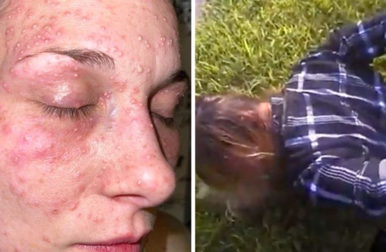 Texas Woman BITTEN by FIRE ANTS During ARREST Claims Police Brutality. But What Does Body Camera Footage Show?