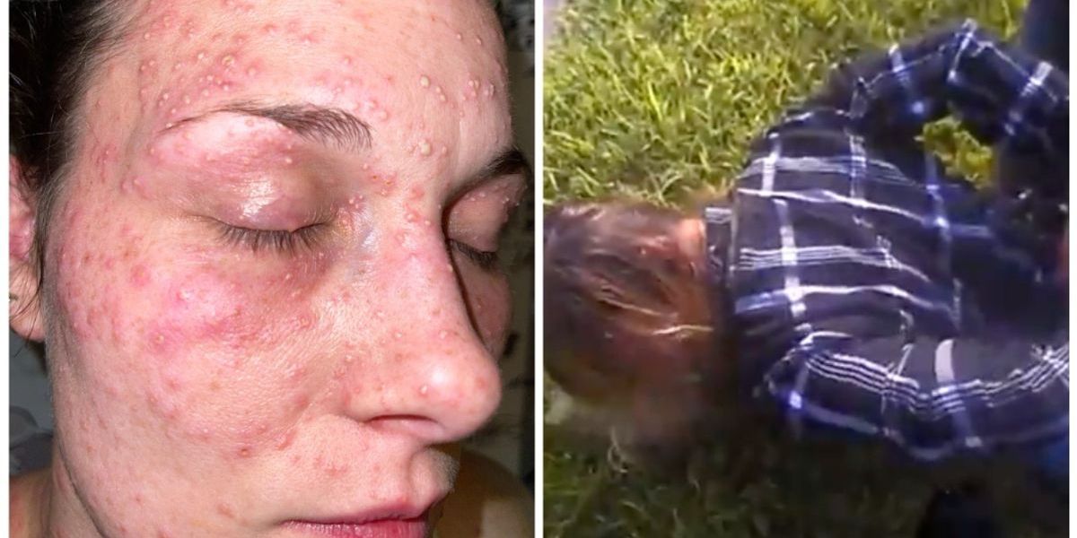 Texas Woman BITTEN by FIRE ANTS During ARREST Claims Police Brutality. But What Does Body Camera Footage Show?