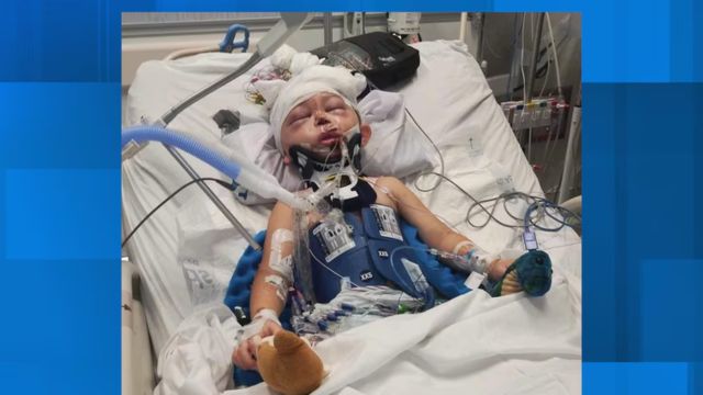 Updates! Family Shares Latest On 5-Year-Old's Journey To Healing Hit By SUV (1)