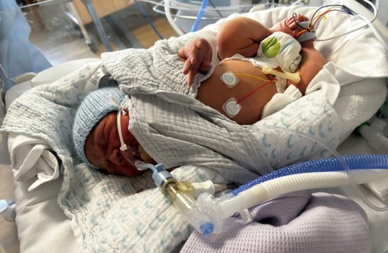 Mum recalls terrifying moment ‘healthy’ newborn Blake started vomiting blood – and bleeding from his nose and bottom