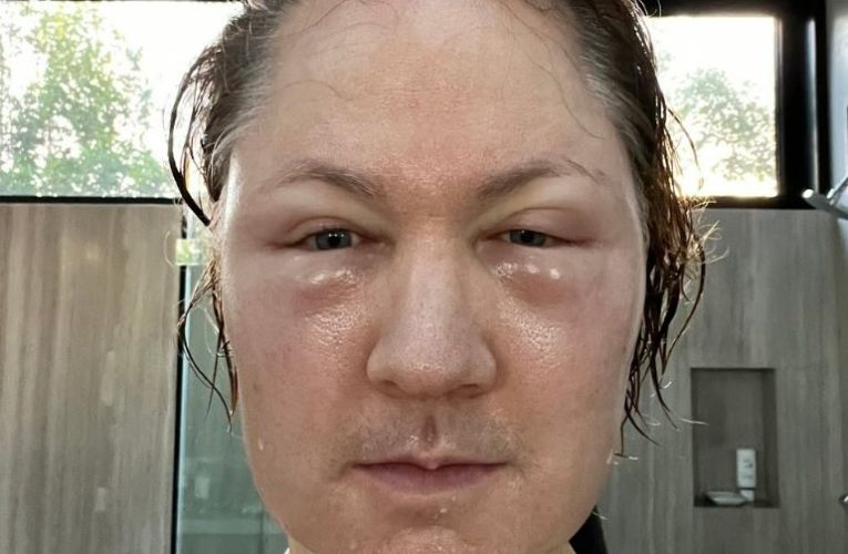 Famous tech billionaire, 47, is unrecognisable after controversial FAT injections – do you know who it is?