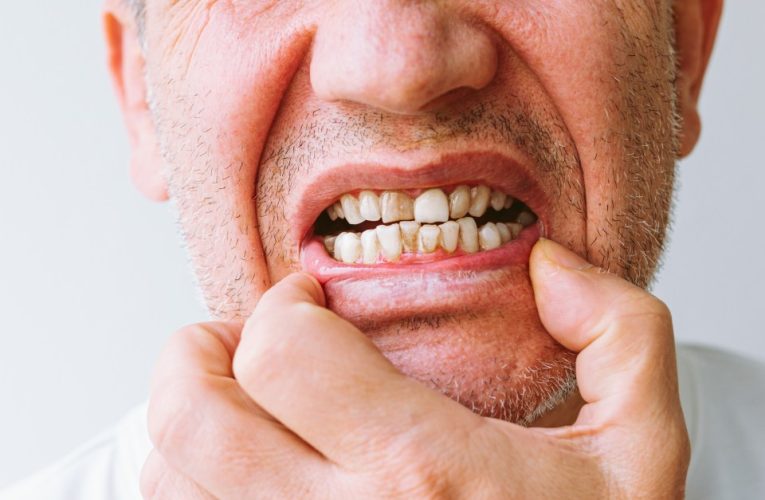 Time-lapse video reveals how your teeth will change in each decade of life