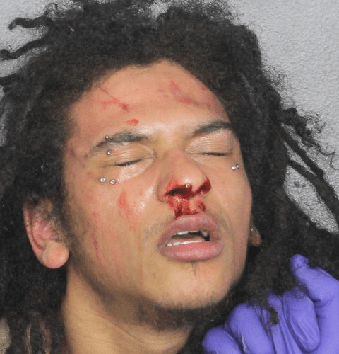 Rapper Jaydes, 18, seen in horrifying mug shot a week after ‘trying to kill woman with box cutter and scissors’