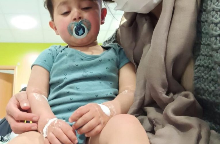 I found out my two-year-old son had cancer after he stubbed his toe on the washing machine