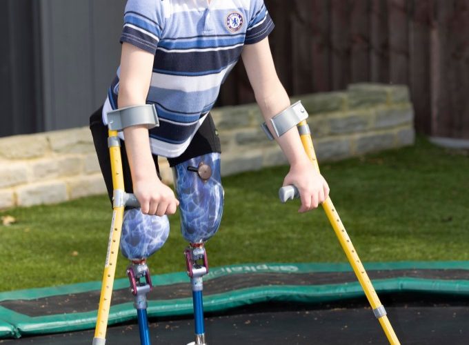 Boy, 10, has ‘miracle’ surgery to help him walk after losing legs due to horrific abuse by parents